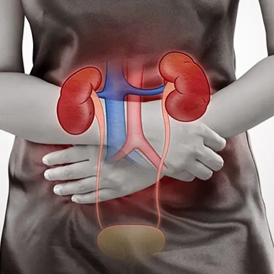 kidney panel extended test